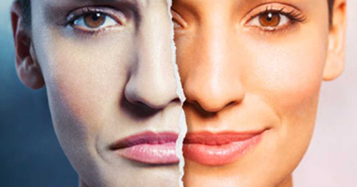 Sei pazzo? No, bipolare. Scoppia la moda del ''disturbo geniale''