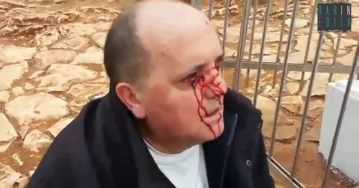 Medjugorje, piange sangue davanti alla statua della Madonna: il video