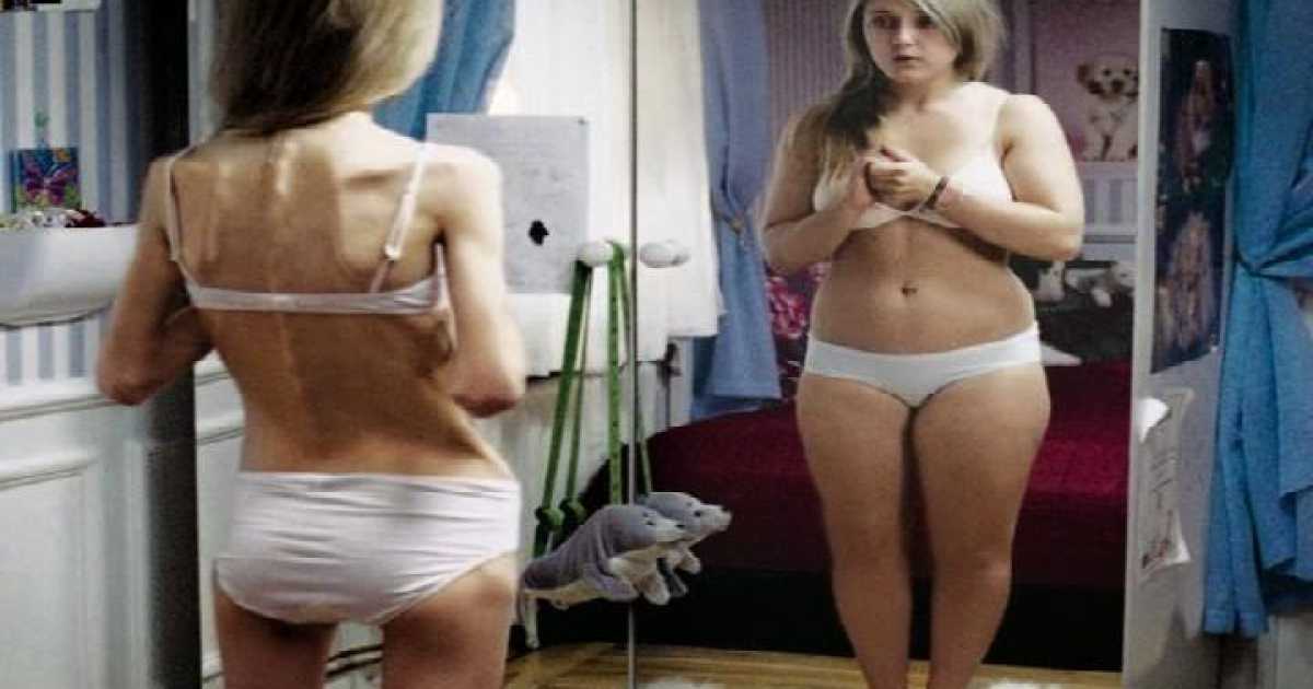 Il magro mondo delle ''pro ana'': �Ho buttato il cibo, mi sento potente�