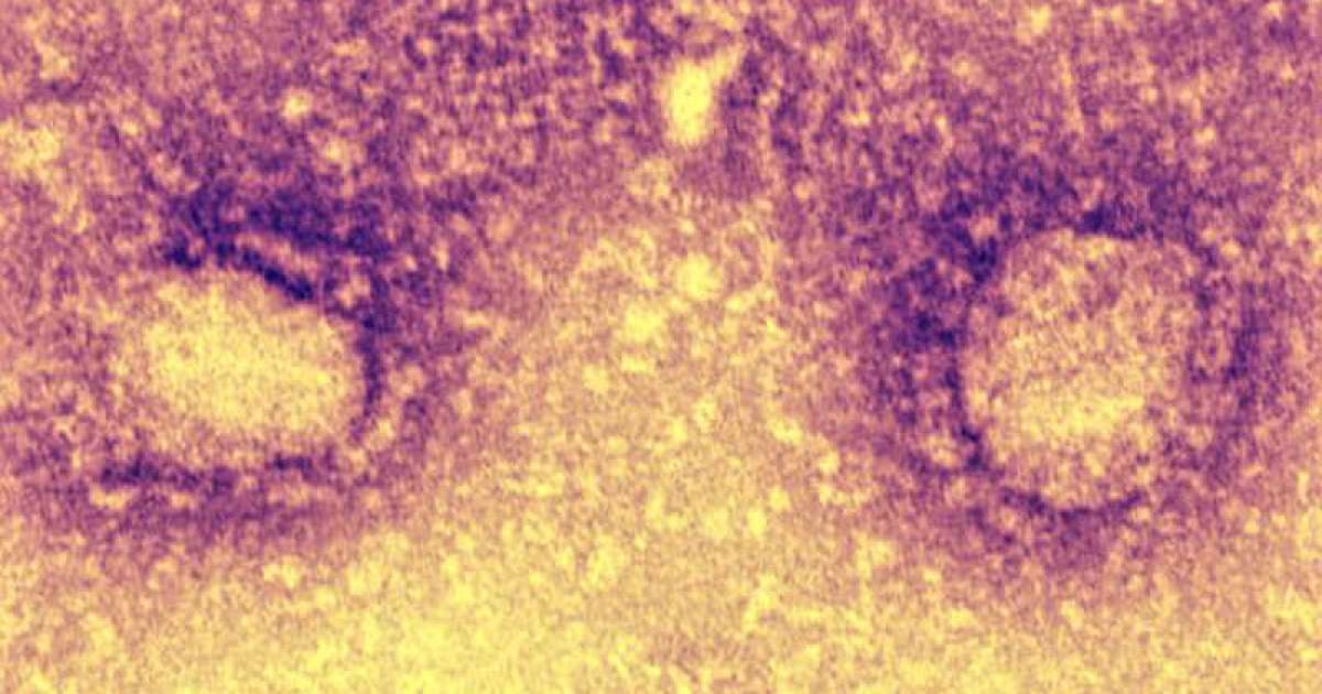 Coronavirus, pi� positivi in Puglia: 120, il 5,51% dei tamponi
