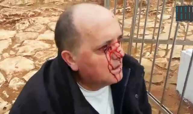 Medjugorje, piange sangue davanti alla statua della Madonna: il video