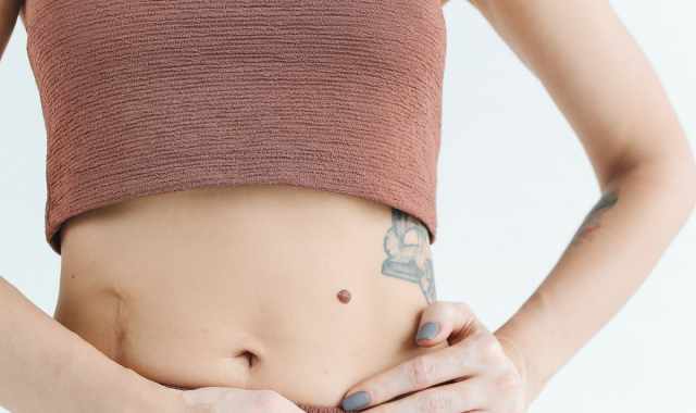 Cicatrici e accettazione del proprio corpo: conseguenze psicologiche e l'importanza di superarle