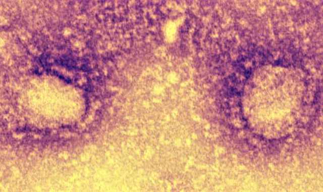 Coronavirus, pi positivi in Puglia: 120, il 5,51% dei tamponi