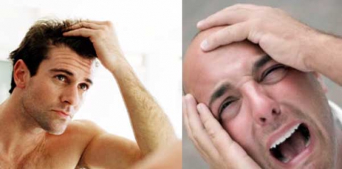 I giovani? Sempre pi� calvi: �Colpa di stress, smog e cattiva alimentazione�