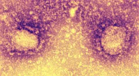 Coronavirus, pi positivi in Puglia: 120, il 5,51% dei tamponi