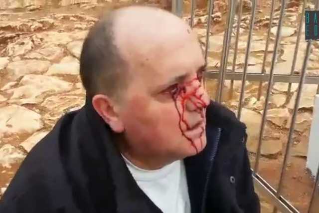 Medjugorje, piange sangue davanti alla statua della Madonna: il video