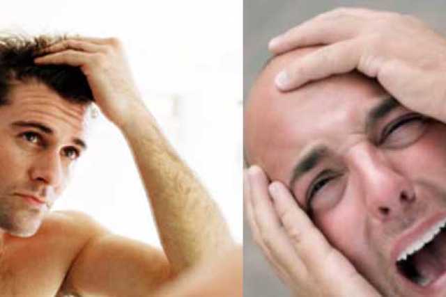I giovani? Sempre pi� calvi: �Colpa di stress, smog e cattiva alimentazione�