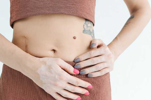 Cicatrici e accettazione del proprio corpo: conseguenze psicologiche e l'importanza di superarle
