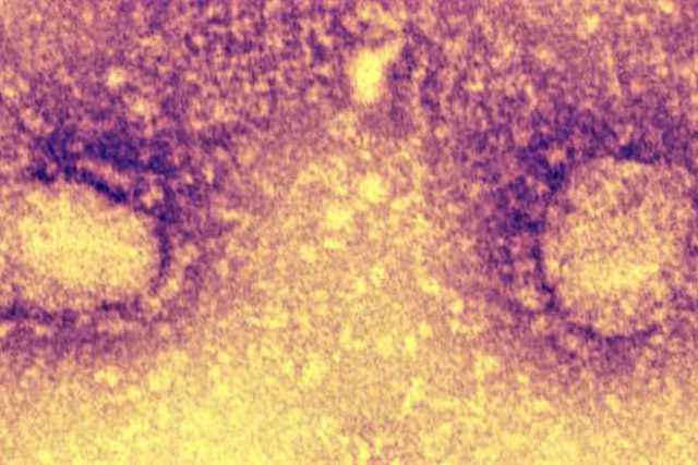 Coronavirus, pi� positivi in Puglia: 120, il 5,51% dei tamponi