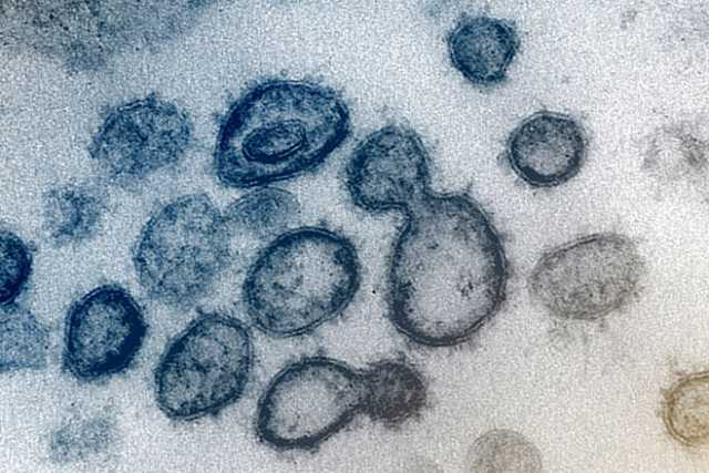 Coronavirus, in Puglia 53 nuovi casi: positivo il 4,6% dei tamponi