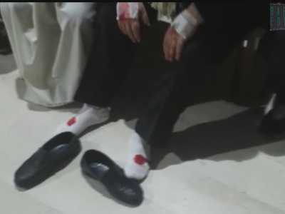 Il signore di Valenzano si toglie le scarpe: anche i calzini appaiono pregni di sangue